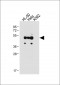 FCGR1B Antibody (C-term)